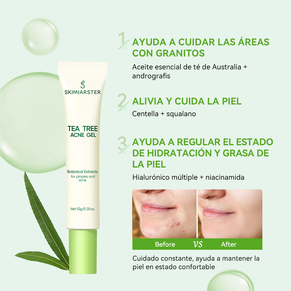 SKINNARSTER Tea Tree Acne Gel (Gel Antiacné de Té de Árbol)
