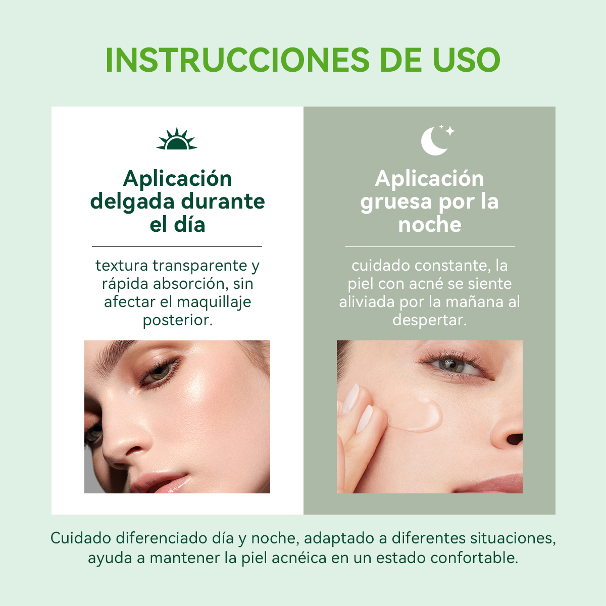 SKINNARSTER Tea Tree Acne Gel (Gel Antiacné de Té de Árbol)